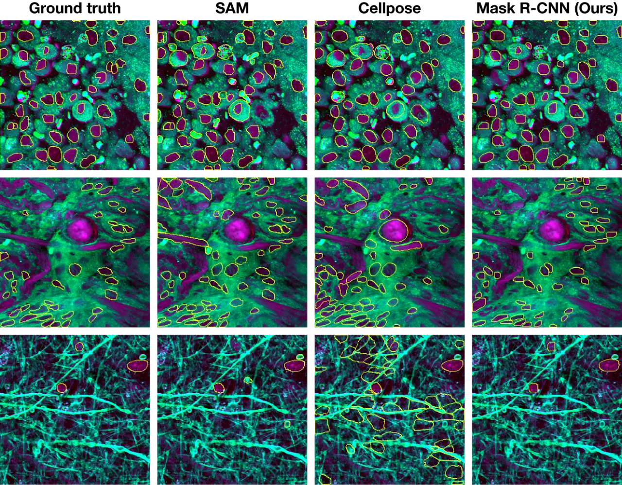 nuclei instance segmentation visualization